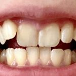 Boka Teeth Whitening Powder – Nano Hydroxyapatite, Toothpaste Alternative for Sensitive Teeth, 1 Pack photo review