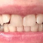 Boka Teeth Whitening Powder – Nano Hydroxyapatite, Toothpaste Alternative for Sensitive Teeth, 1 Pack photo review