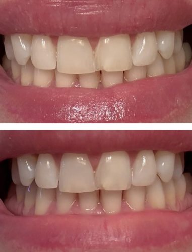 Mouthology Nano Hydroxyapatite Toothpaste – Fluoride Free, Whitening & Enamel Care, Mint 4 oz photo review